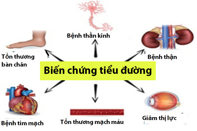 Bệnh đái tháo đường và cách phòng ngừa 