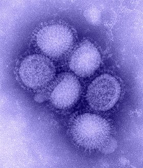 Cúm A/H1N1 cần được phát hiện sớm tránh tử vong